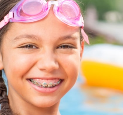 Orthodontics for teens and kids